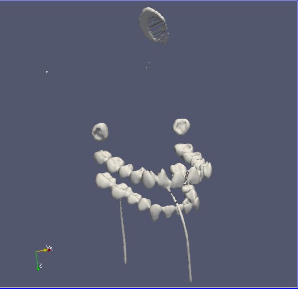 ParaView rendering of the teeth from the head grid data set